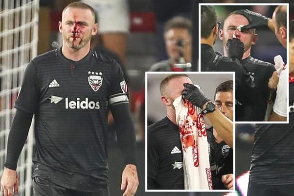 Điểm tin bóng đá chiều nay (30/7): Wayne Rooney gặp chấn thương kinh hoàng ở Mỹ